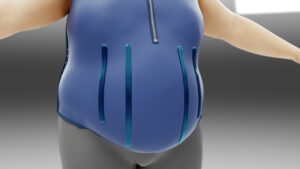 ceinture obesite novavita.jpg